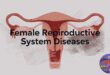 Female Reproductive System Diseases: Symptoms & Treatment Guide