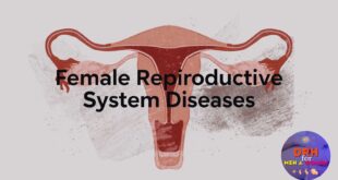 Female Reproductive System Diseases: Symptoms & Treatment Guide